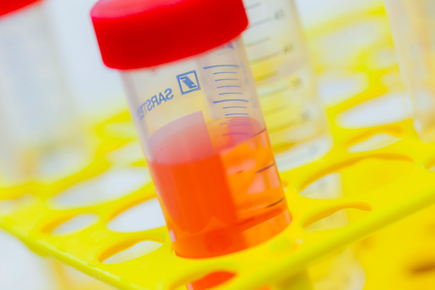 Test tubes