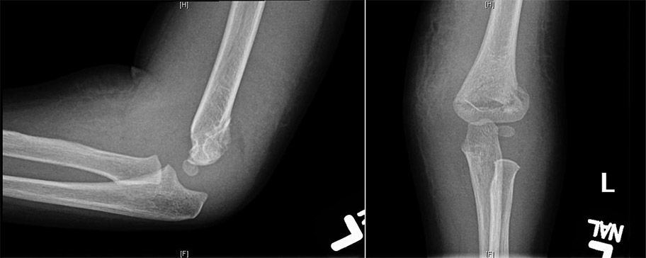 X-ray