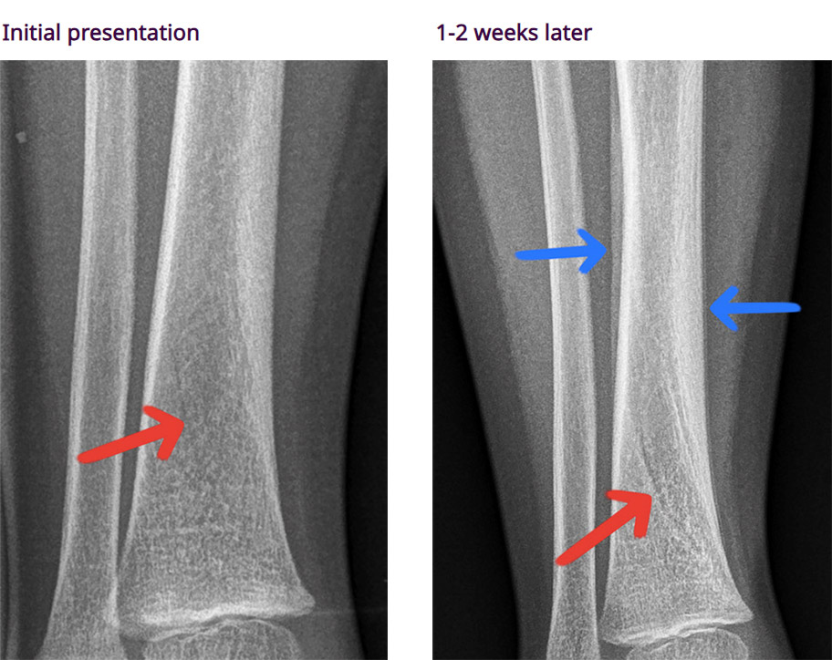 X-ray presentations case 4